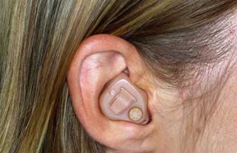 Centro Auditivo Phonak - Foto 1