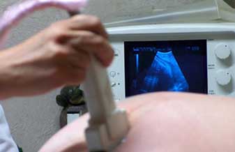 João Paulo Lopes Brosso - Foto 1